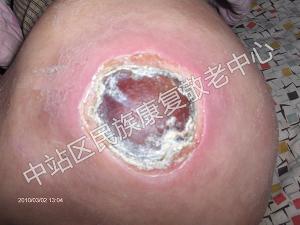 成功案例